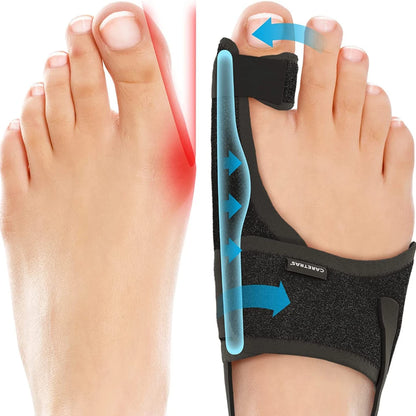 Correcteur d'Orteille HALLUX VALGUS