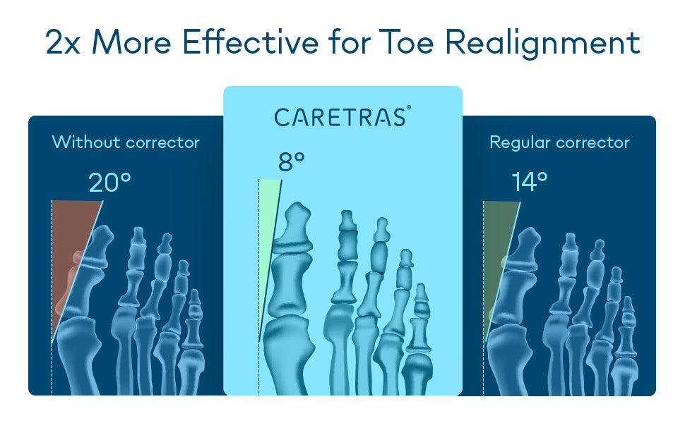 Correcteur d'Orteille HALLUX VALGUS